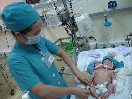 Chưa tìm được phương án “giải cứu” bé hai đầu - 1 Chưa tìm được phương án “giải cứu” bé hai đầu - 1