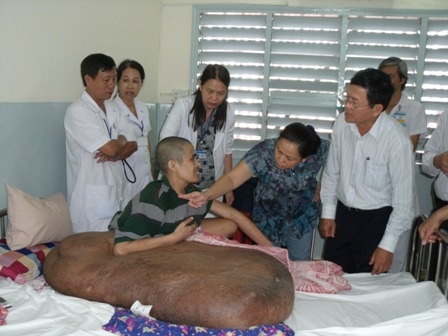 Chuyên gia Mỹ “can thiệp” cho người mang khối bướu khổng lồ - 1