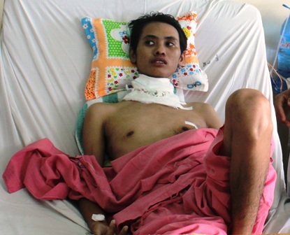 Sức sống kỳ diệu của bệnh nhân bị dập nát khí quản - 1