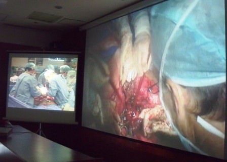 Cắt khối bướu 90kg khỏi cơ thể bệnh nhân Duy Hải - 2