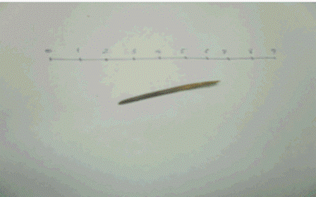 Thủng ruột vì... ngậm tăm khi ngủ - 1