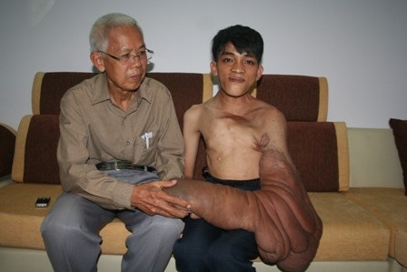 “Dị nhân” mang bướu khổng lồ cầu cứu - 1