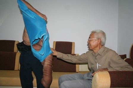 “Dị nhân” mang bướu khổng lồ cầu cứu - 3