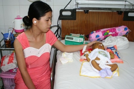 Xót xa trước bé gái 2 tháng tuổi bị liệt nửa mặt