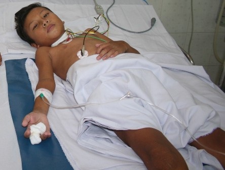 Cụt ngón tay vì bị rắn cạp nia cắn