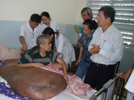Bệnh nhân từng mang bướu 90kg rạng rỡ ngày xuất viện