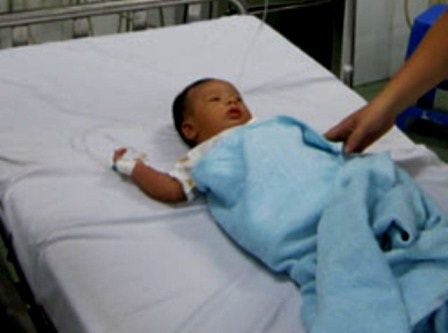 Bé 1 tháng tuổi nhập viện vì bị tẩy lông tơ - 1 Bé 1 tháng tuổi nhập viện vì bị tẩy lông tơ