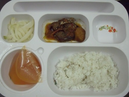 Bữa ăn nghèo dinh dưỡng khiến nhiều công nhân rơi vào tình trạng thiếu máu