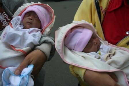 Nhiều khả năng 2 bé còn lại sẽ phải phẫu thuật để can thiệp bệnh lý võng mạc