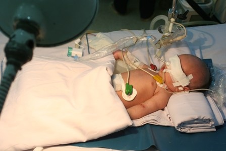 Uốn ván sơ sinh là loại bệnh đặc biệt nguy hiểm rất khó cứu chữa