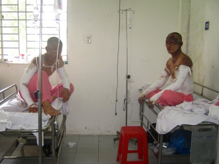 Những người bị bỏng trung bình đang dần bình phục