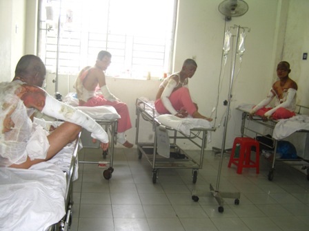 Nhiều nạn nhân đã cố chạy nhưng vẫn bị lửa thiêu cháy vùng sau cơ thể.