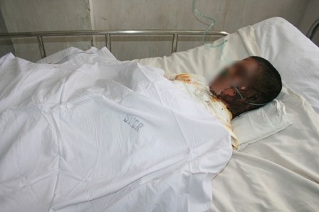 Tai nạn điện thường để lại những hậu quả rất nặng nề