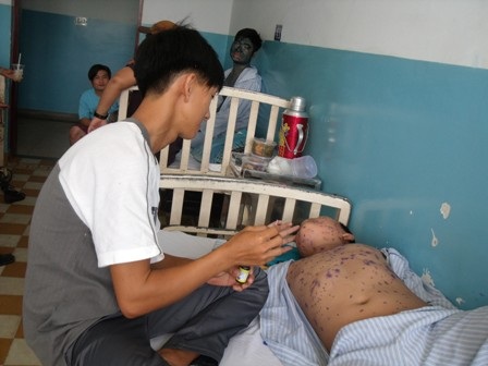 Bệnh thủy đậu có thể gây ra biến chứng nguy hiểm nếu không điều trị kịp thời (Ảnh minh họa)