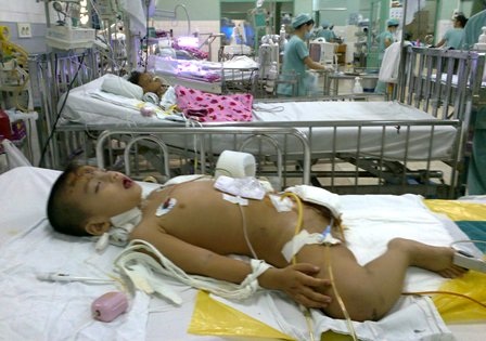 Quỹ Nhân ái “hỏa tốc” hỗ trợ 10 triệu đồng đến bé cụt chân mất cha mẹ - 1 Thiên Bảo sẽ còn phải trải qua rất nhiều cuộc phẫu thuật