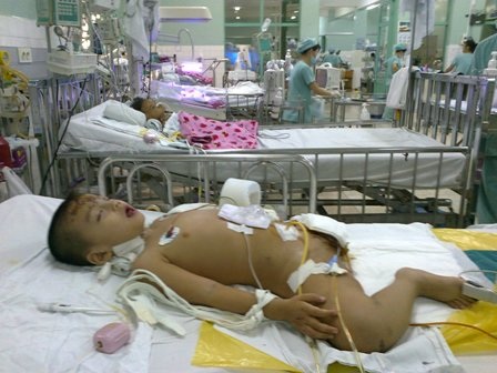 Bé Thiên Bảo chưa thể qua được nguy kịch - 1 Thiên Bảo đang phải chịu nỗi đau quá lớn về thể xác và tinh thần