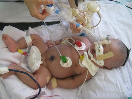 Cháu bé vô danh đang đứng trước nguy cơ bị cha mẹ bỏ rơi