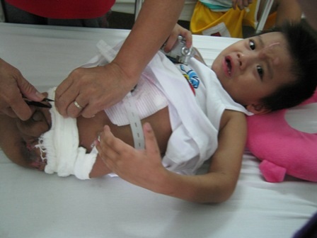 Cháu vẫn còn đau đớn khi mỗi lần được thay băng