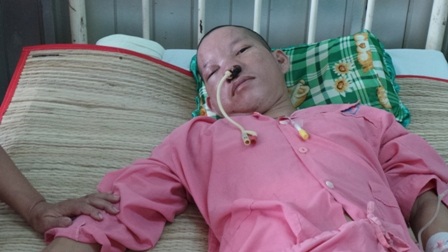 Nếu không được can thiệp, anh Tùng có thể tử vong bất kỳ lúc nào