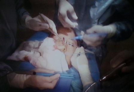 Mũi dao đầu tiên đặt xuống để giải thoát cho bệnh nhân