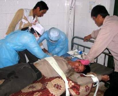 Chủ quan khi bị chó mèo cắn là xem thường tính mạng (ảnh minh họa: Internet)