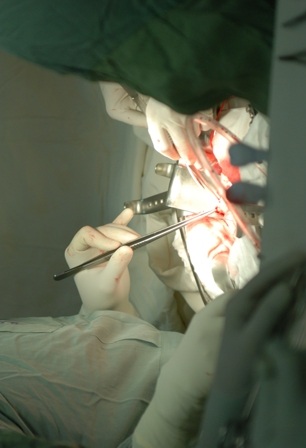 Bác sĩ đã cắt bỏ động mạch phình và tái tạo lại mạch máu cho bệnh nhân