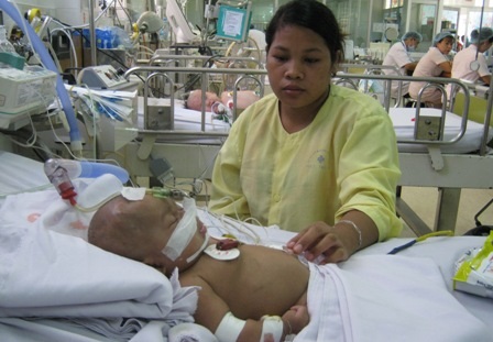 Số ca uốn ván sơ sinh chủ yếu tập trung ở vùng sâu vùng xa