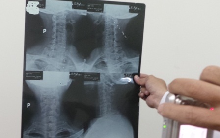 Một tấm phim A được ghép và cắt thành 4 tấm phim B