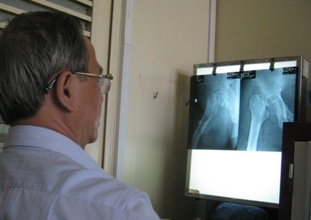 Hình ảnh trên phim cho thấy hai khớp háng của bệnh nhân đã bị mục