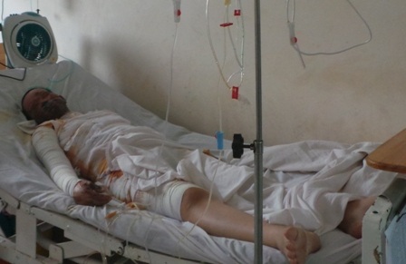 Bỏng lửa xăng là tai nạn đặc biệt nguy hiểm