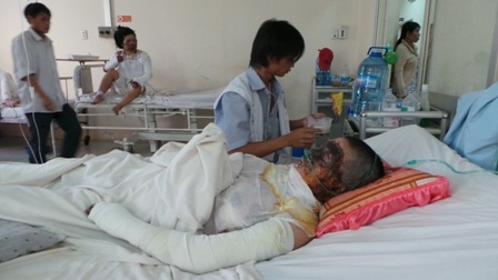 Chị Ánh Kiều những ngày còn điều trị tại Chợ Rẫy