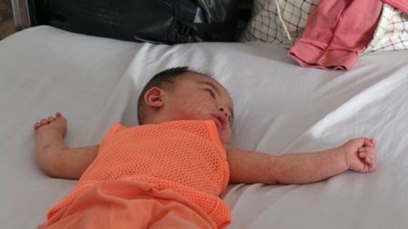 Mới 6 tháng tuổi nhưng bé Minh Khang đã bị bệnh sởi tấn công