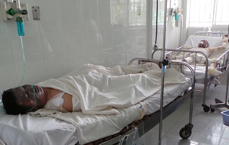 Một trong số 4 nạn nhân của vụ nổ bị bỏng nặng không qua được nguy kịch