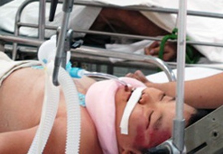 Ba bà cháu bị con nghiện truy sát đang nguy kịch - 1 Bé Thành bị nứt hộp sọ, xuất huyết não rải rác (ảnh: Trung Kiên)