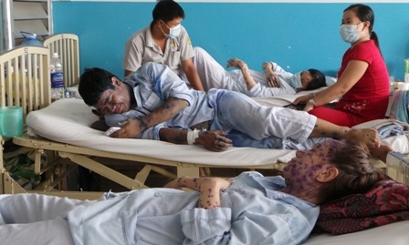 Cháy vắc-xin là nguyên nhân chính khiến thủy đậu gia tăng