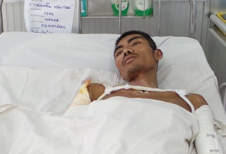Ánh mắt khắc khoải của anh Nhí trước nguy cơ phải kết thúc sự sống