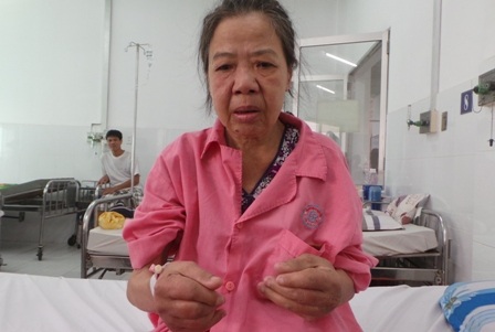 Bà Dưa với đôi bàn tay sưng phù đau nhức 