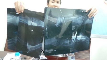 Những tấm phim cắt ghép tại bệnh viện Chấn thương Chỉnh hình bị Thanh tra Sở Y tế thu giữ