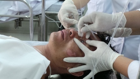 Bác sĩ tiến hành rửa mắt liên tục cho người bệnh