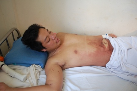 Nạn nhân thấy mình quá may mắn khi sống sót sau 5 ngày bị vùi ở nhiệt độ âm 