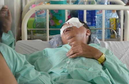 Con mắt trái của ông Lương đã buộc phải múc bỏ