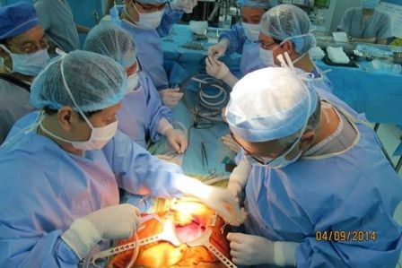 Ca ghép gan thứ 8 thành công tại Nhi Đồng 2