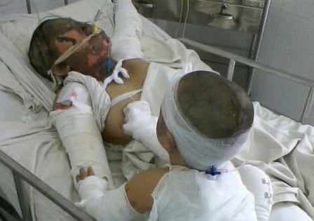 Mẹ con chị T.L khi được điều trị tại Chợ Rẫy