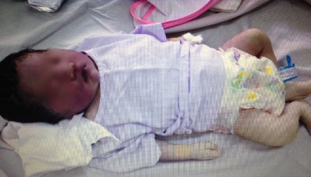 Cháu bé với đầu mặt tím ngắt, chân tay trắng bệch (ảnh: anh Minh cung cấp)