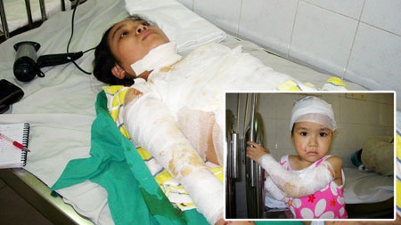 Mẹ và con gái 4 tuổi bị tạt axit - 1 Mẹ và con gái 4 tuổi bị tạt axit