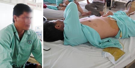 Rộ chuyện vợ bạo hành chồng: Đòn độc của “phái yếu” - 1 Đến giờ anh Nguyễn Hòa D. vẫn không thể ngờ vợ mình có thể ra đòn độc như thế.