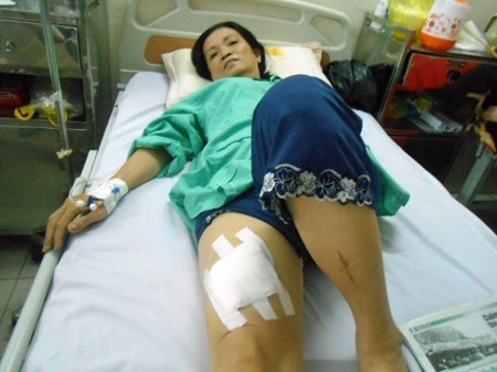 Truy bắt hung thủ đâm bà chủ tiệm tạp hóa - 1 Nạn nhân Nguyễn Thị Như Ý đang điều trị tại BV 115 với nhiều vết thương trên cơ thể.