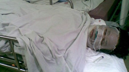 Tẩm xăng thiêu sống 2 con, bố cũng tử vong - 1 Vũ Duy Hiến tại bệnh viện Việt-Tiệp (Hải Phòng)