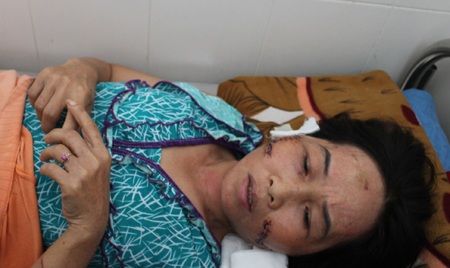 Chị Lê Thị Thủy đang được điều trị tại bệnh viện.