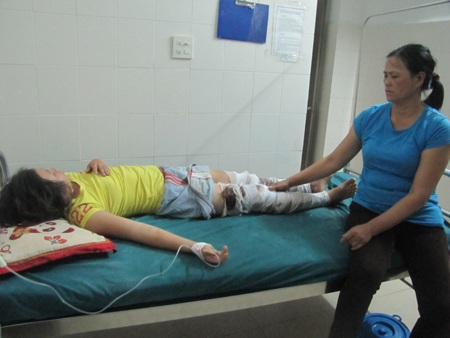 Tưới xăng thiêu sống vợ vì cho rằng không lễ phép - 1 Chị Lê Thị Thu Thủy đang chữa trị tại Bệnh viện Đa khoa tỉnh Phú Yên